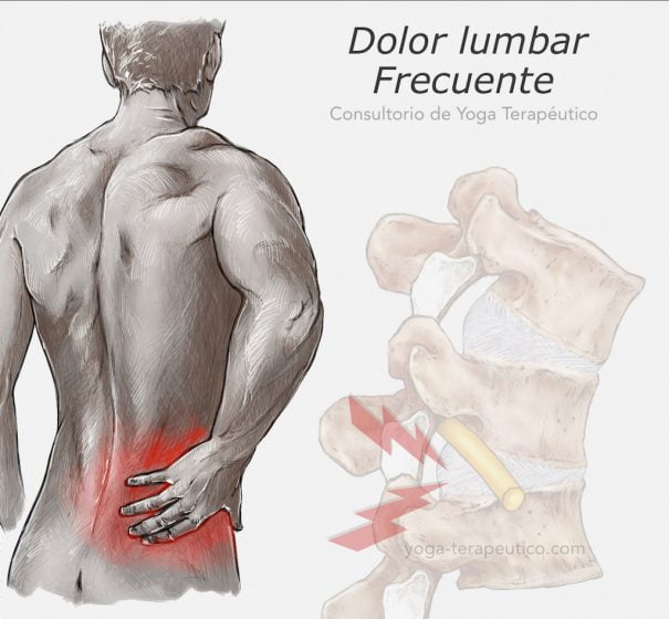 terapeutico_lumbar