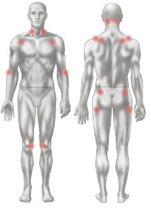 6Yogaterapeutico